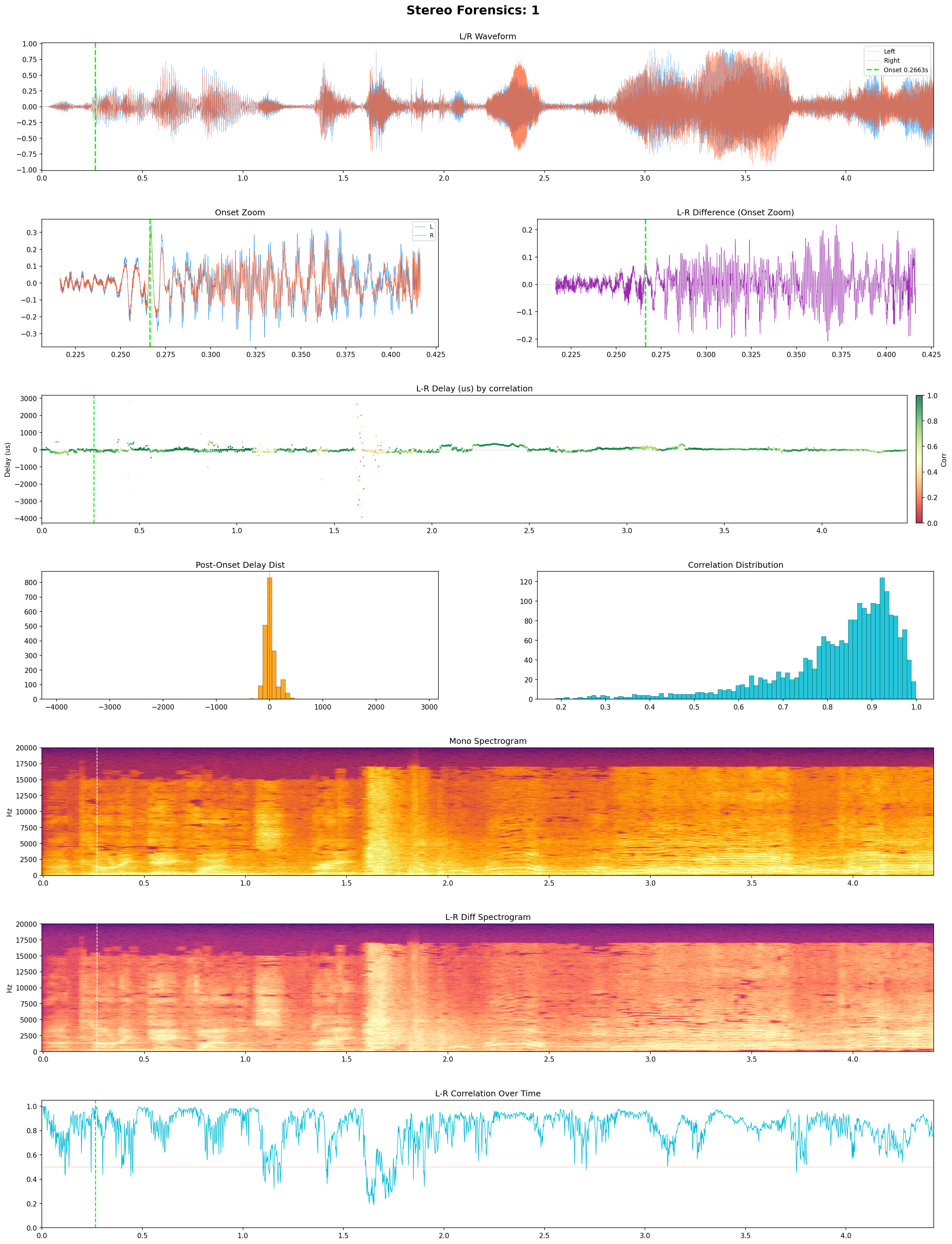 View 1 stereo audio analysis